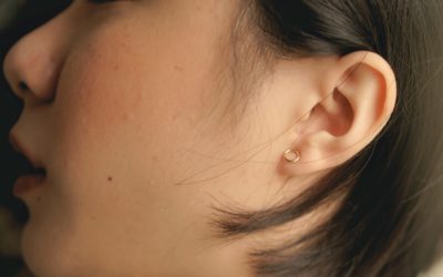 Ohr-Akupunktur gegen neue Stresskrankheiten